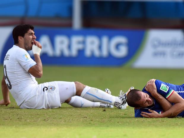 Luis Suarez holds his teeth after colliding with Giorgio Chiellini Luis Suarez holds his teeth after colliding with Giorgio Chiellini. GETTY Luis Suarez holds his teeth after colliding with Giorgio Chiellini Luis Suarez holds his teeth after colliding with Giorgio Chiellini. GETTY