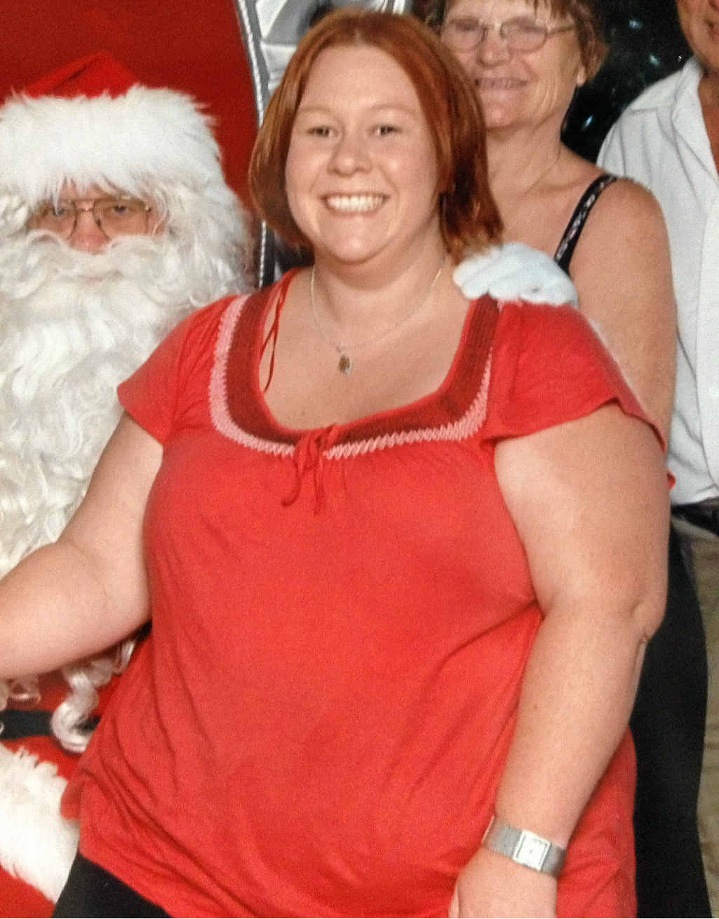 BEFORE: Donna Fenton before her amazing weight loss program. BEFORE: Donna Fenton before her amazing weight loss program.