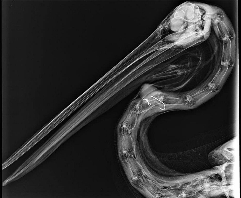 An X-ray of Vera, the pelican, who needed surgery after getting tangled in fishing line and a hook. An X-ray of Vera, the pelican, who needed surgery after getting tangled in fishing line and a hook.