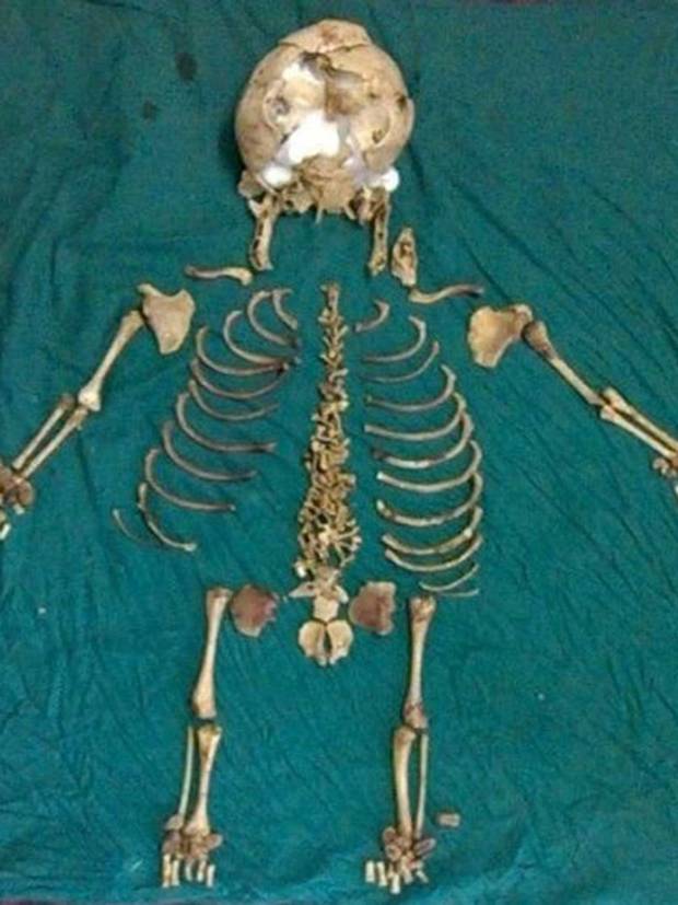 The re-arranged skeleton of the foetus. The re-arranged skeleton of the foetus.