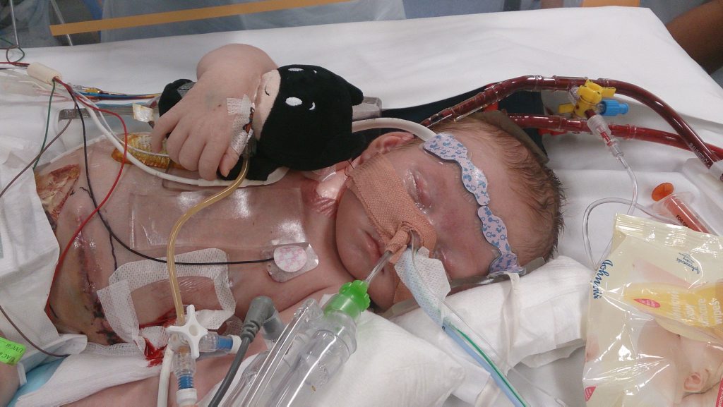 Kurt Blayney on life support. Kurt Blayney on life support.