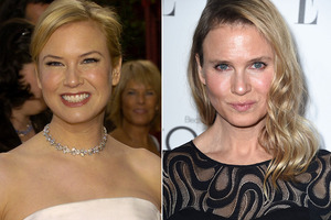 Renee Zellwegger... before and after. Renee Zellwegger... before and after.