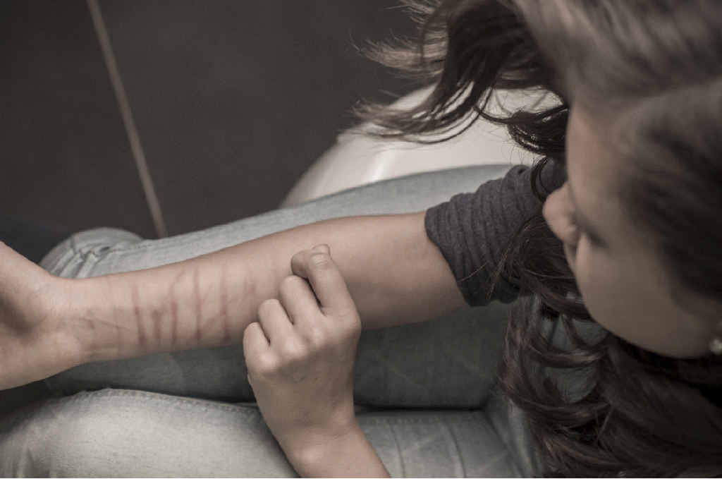 WARNING SIGNS: Warwick parents are being urged to be on the lookout for cutting and other self-harming methods. WARNING SIGNS: Warwick parents are being urged to be on the lookout for cutting and other self-harming methods.