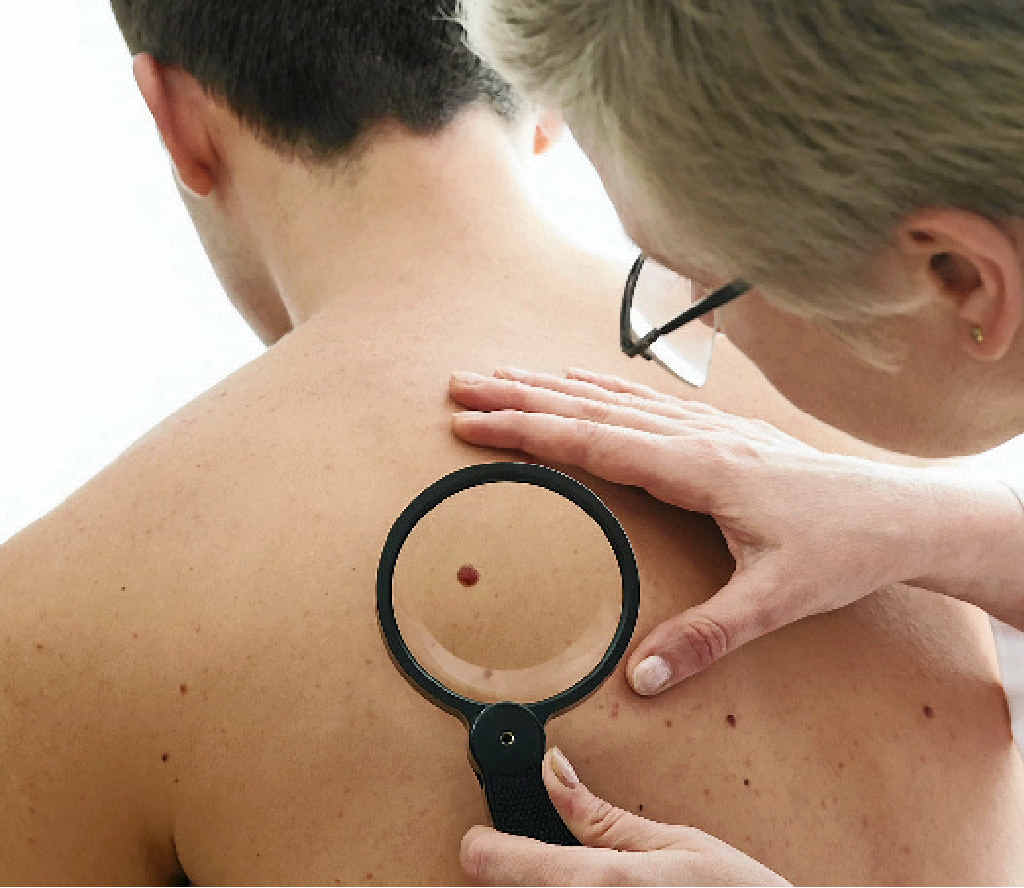 DEADLY: Getting your skin checked may well save your life. DEADLY: Getting your skin checked may well save your life.