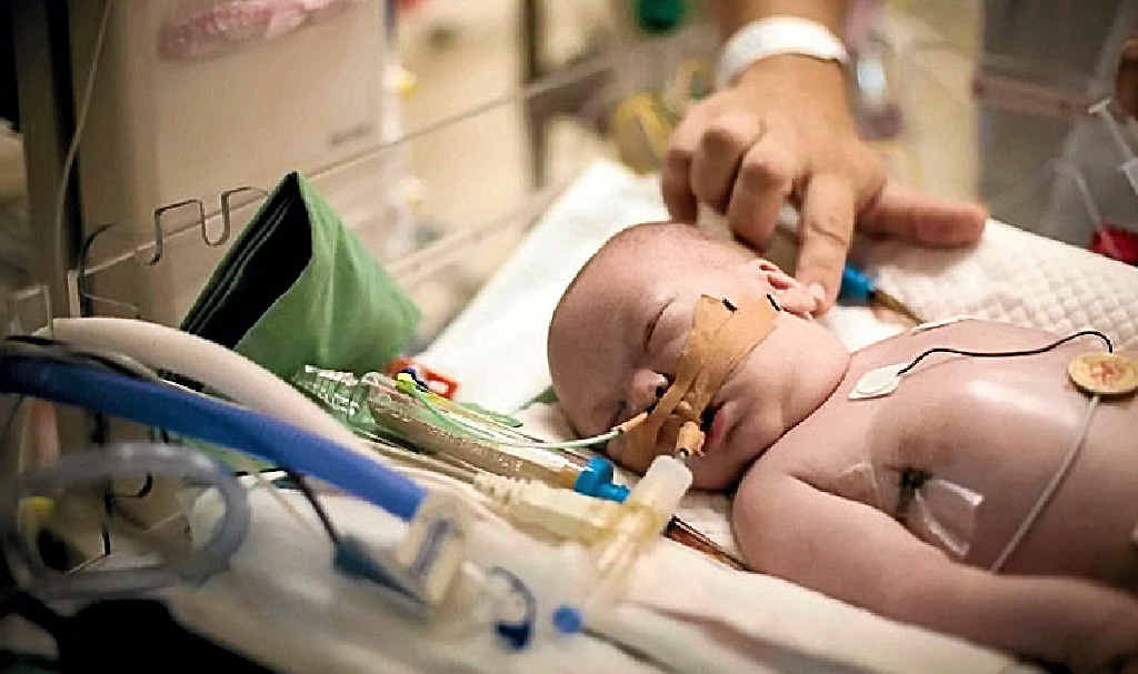 FIGHT FOR LIFE: Six weeks ago Amelia Donohue was born with her umbilical cord around her neck. She continues to astound doctors. FIGHT FOR LIFE: Six weeks ago Amelia Donohue was born with her umbilical cord around her neck. She continues to astound doctors.