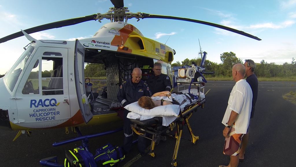 RACQ Capricorn Helicopter Rescue Service retrieved a Yeppoon teenager from Great Keppel Island who had a suspected Irukandji sting. RACQ Capricorn Helicopter Rescue Service retrieved a Yeppoon teenager from Great Keppel Island who had a suspected Irukandji sting.