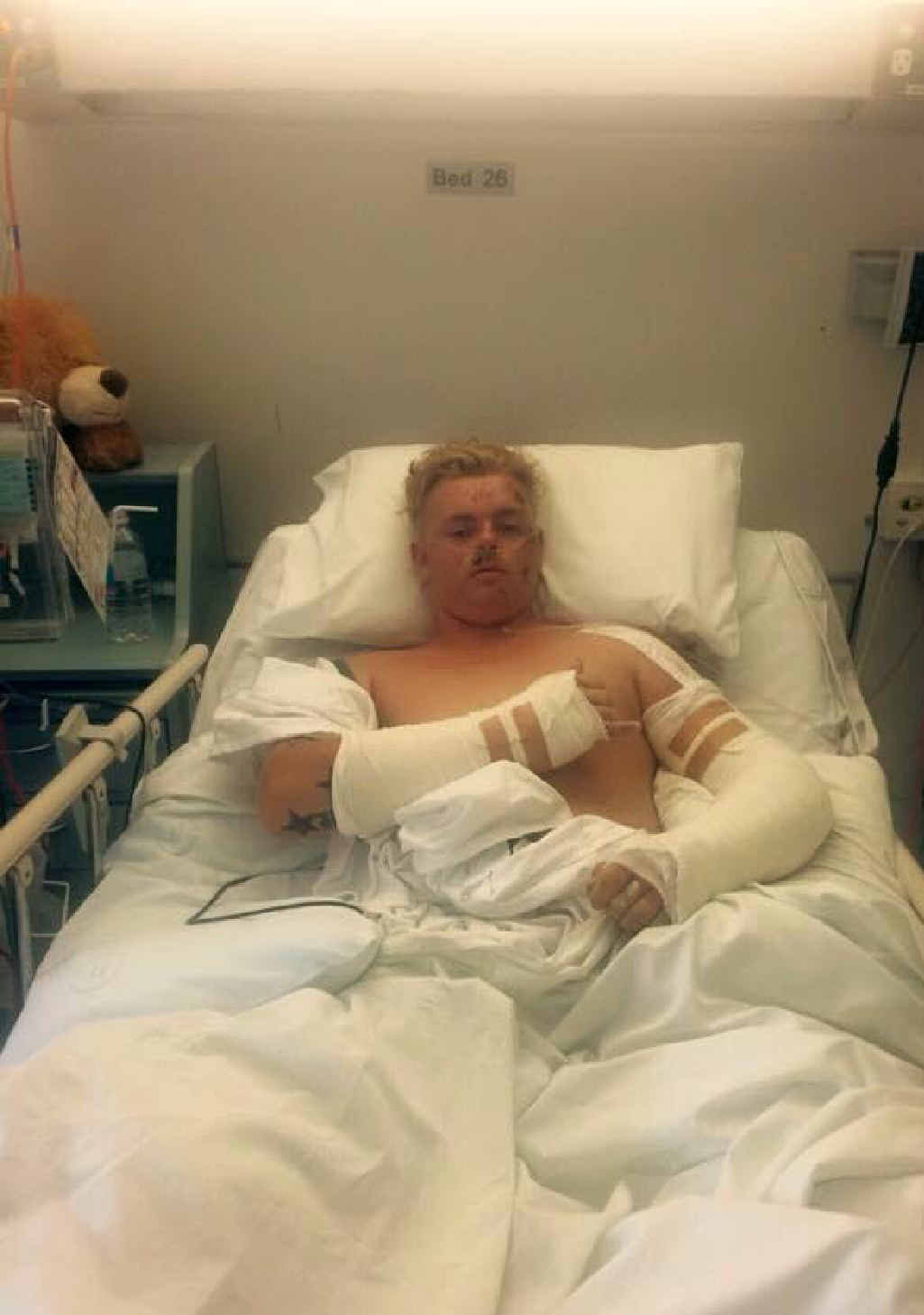 The teenager suffered multiple fractures and spent weeks in hospital, where he had numerous operations The teenager suffered multiple fractures and spent weeks in hospital, where he had numerous operations