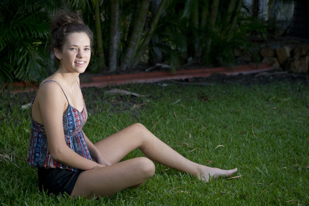 Rachael Shardlow five years on from her horrific ordeal when stung by a box jellyfish. Rachael Shardlow five years on from her horrific ordeal when stung by a box jellyfish.