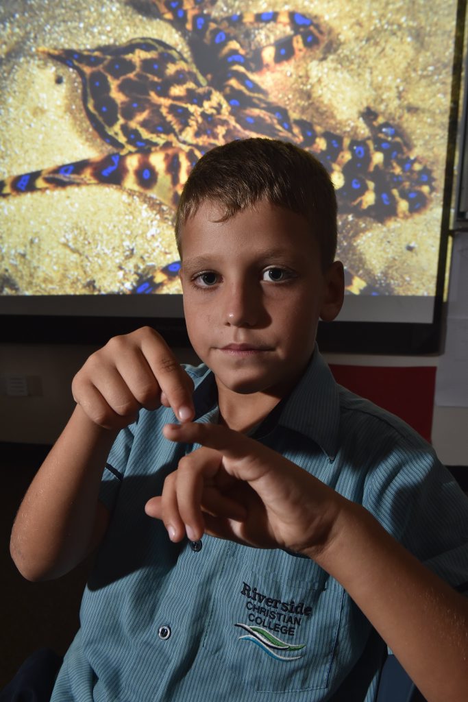 Heydon Wilson, 8, points to where he was stung on his finger by a blue-ringed octopus. Heydon Wilson, 8, points to where he was stung on his finger by a blue-ringed octopus.
