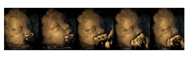 A baby developing in the womb of a non-smoking woman A baby developing in the womb of a non-smoking woman