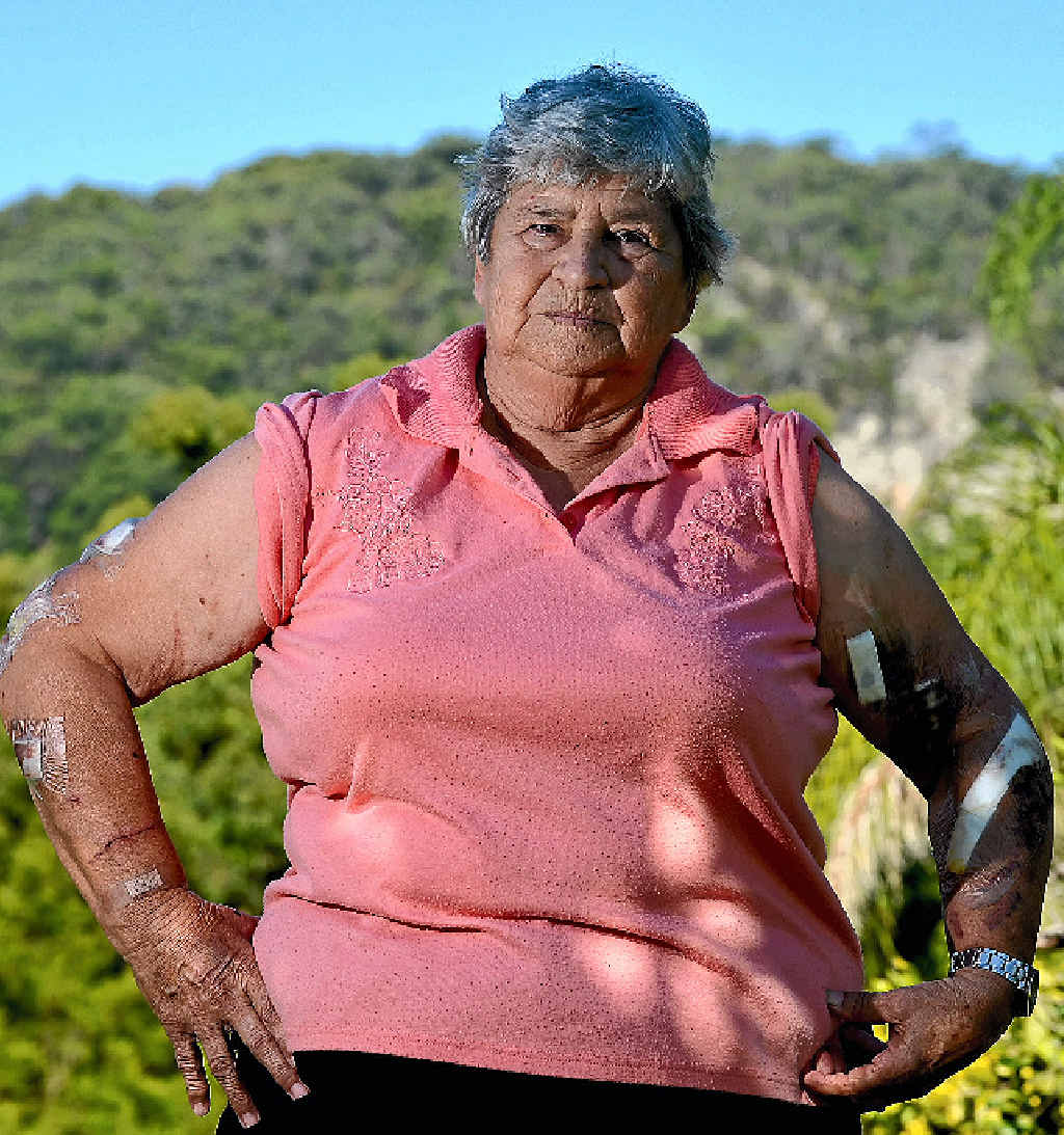 SHOCKED: Ninderry great grandmother Esma Armstrong, savagely attacked by a female kangaroo protecting her joey, is warning others to be careful. SHOCKED: Ninderry great grandmother Esma Armstrong, savagely attacked by a female kangaroo protecting her joey, is warning others to be careful.