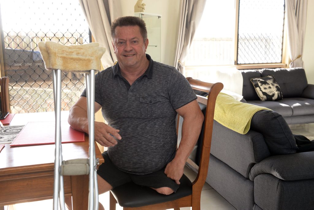 NEW LEG: Ken Pashley is raising funds for an operation to enable him to walk again. Photo: Mike Knott / NewsMail NEW LEG: Ken Pashley is raising funds for an operation to enable him to walk again. Photo: Mike Knott / NewsMail