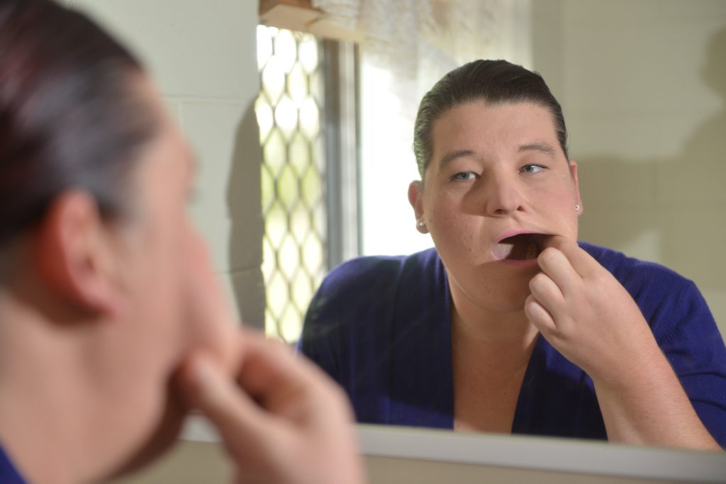 TOOTH ACHES: Sarah Mannion had the wrong tooth extracted by a dentist at the Gympie Hospital this week. Craig Warhurst TOOTH ACHES: Sarah Mannion had the wrong tooth extracted by a dentist at the Gympie Hospital this week. Craig Warhurst