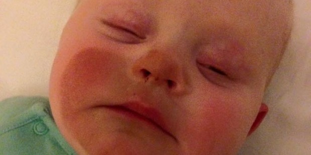 British baby boy had an unfortunate experience with spray tan. Photo / The Unmumsy Mum Facebook British baby boy had an unfortunate experience with spray tan. Photo / The Unmumsy Mum Facebook