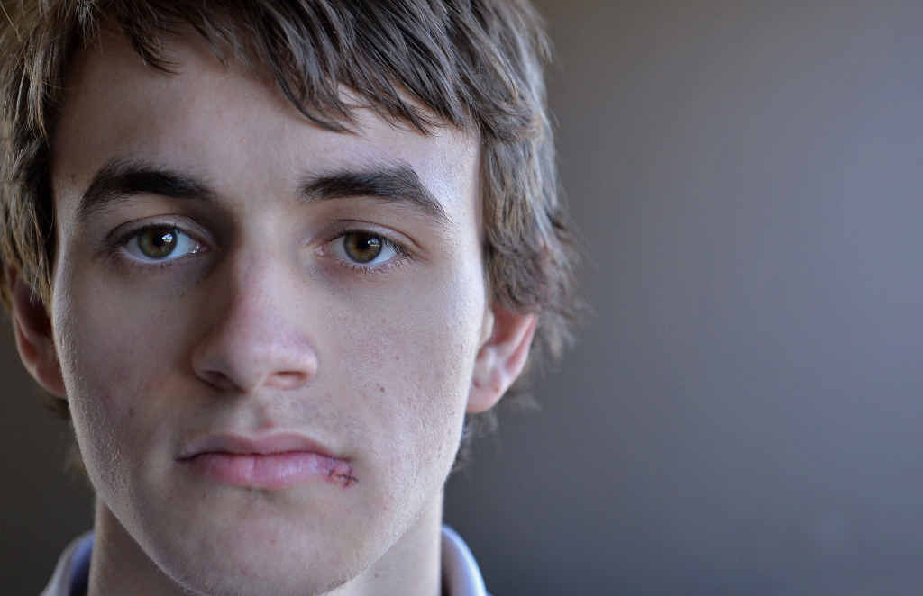 DAYLIGHT ATTACK: Kureelpa teen Ben Read suffered a cut lip and bruises to his stomach after being randomly bashed at Mooloolaba. DAYLIGHT ATTACK: Kureelpa teen Ben Read suffered a cut lip and bruises to his stomach after being randomly bashed at Mooloolaba.