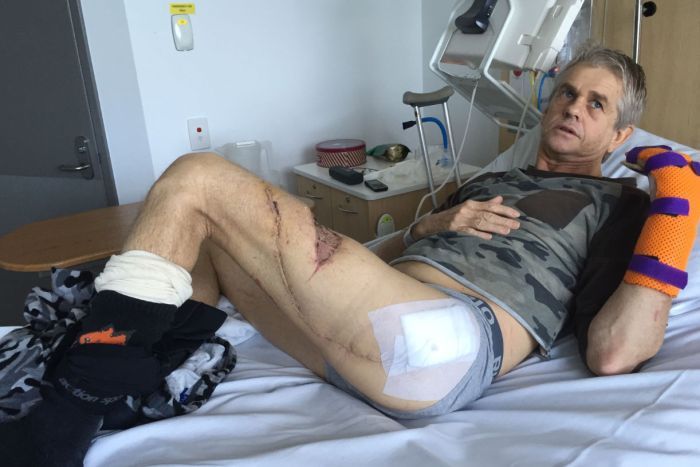 Craig Ison following the August attack. Craig Ison following the August attack.