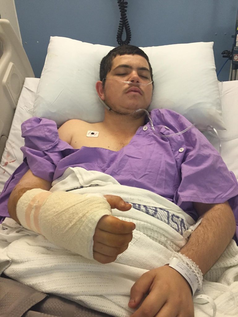 18-year-old Jryah Sammut received these injuries after being attacked by a ridgeback. Photo: contributed 18-year-old Jryah Sammut received these injuries after being attacked by a ridgeback. Photo: contributed