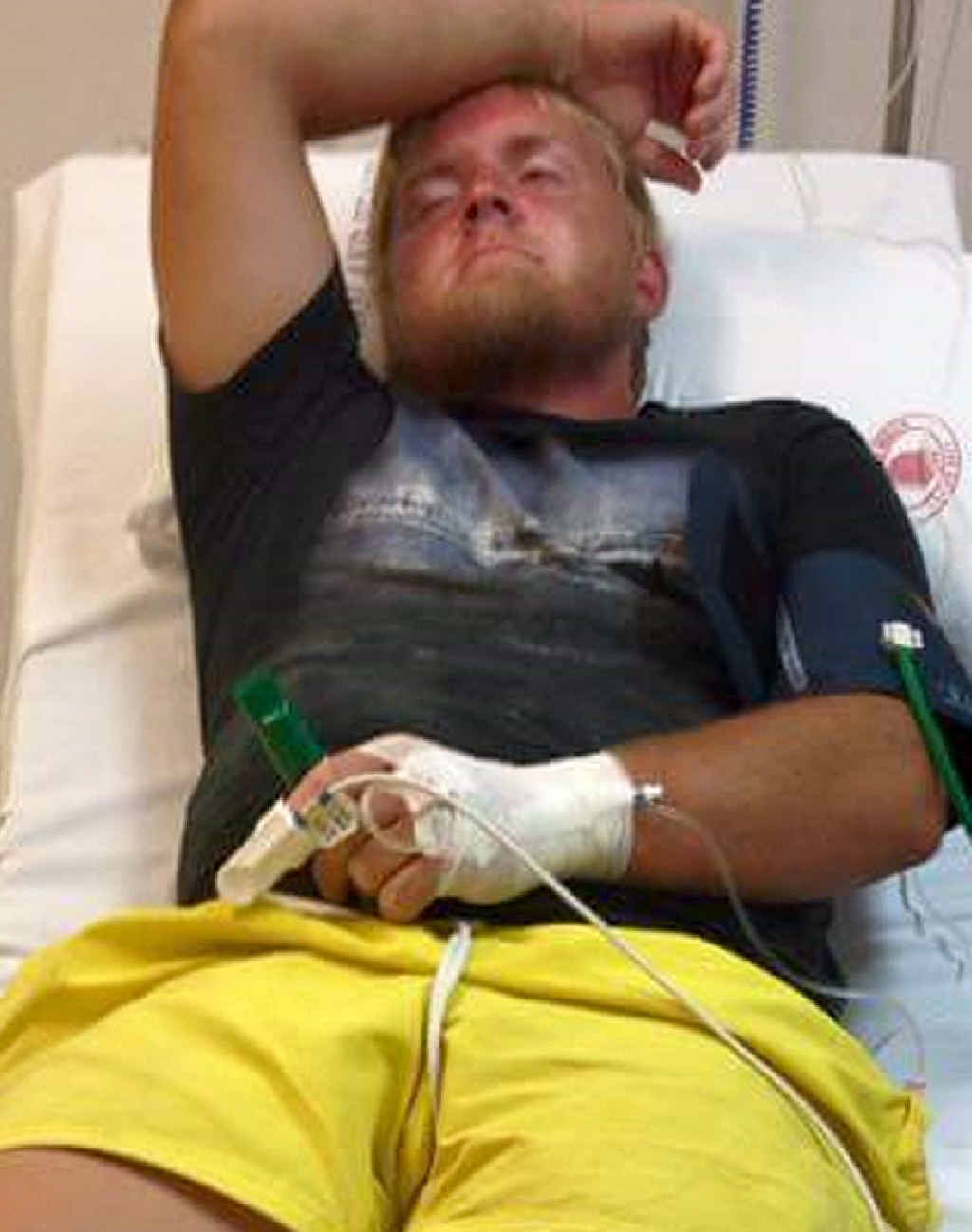 Daniel Wickham was taken to hospital after being stung by a stingray. Daniel Wickham was taken to hospital after being stung by a stingray.