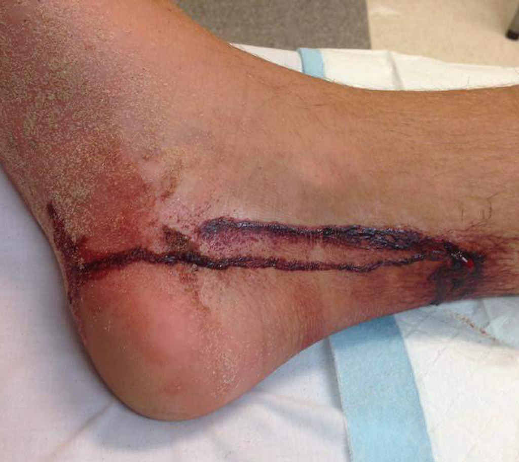 Mr Wickham’s battle wound. Mr Wickham’s battle wound.