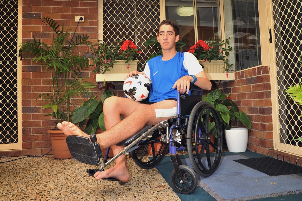 CLOSE CALL: Josh Keenan of Buderim is recuperating after surgery for compartment syndrome. CLOSE CALL: Josh Keenan of Buderim is recuperating after surgery for compartment syndrome.