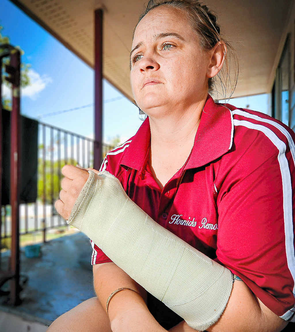 ORDEAL: Angie Rich is terrified of dogs after the Australia Post contractor had her arm broken when a dog bit her arm when she was delivering a package to a Boyne Island home. ORDEAL: Angie Rich is terrified of dogs after the Australia Post contractor had her arm broken when a dog bit her arm when she was delivering a package to a Boyne Island home.