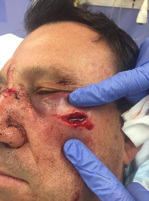 A member of the New South Wales Police Dog Unit in Coffs Harbour was injured overnight. A member of the New South Wales Police Dog Unit in Coffs Harbour was injured overnight.