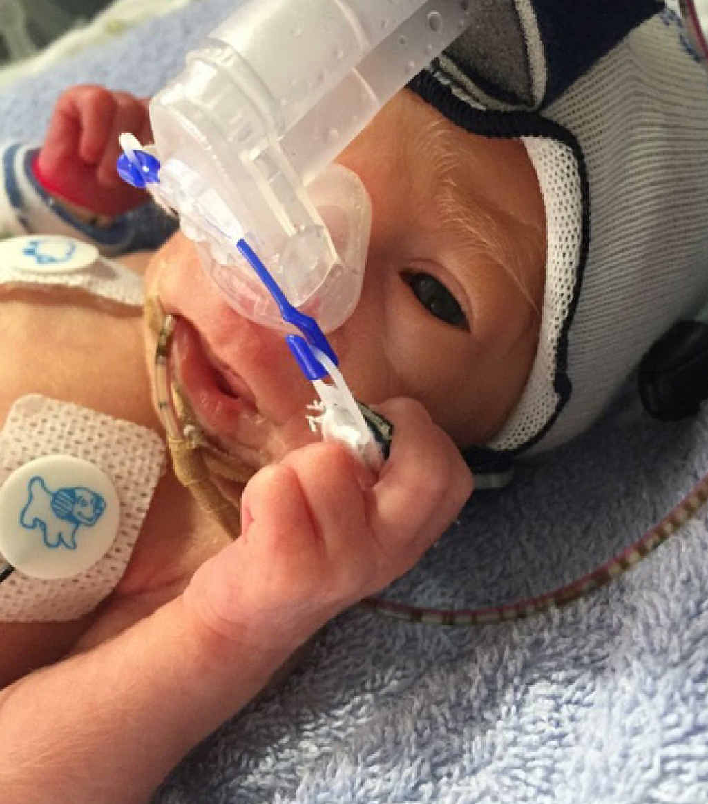 Isabella Taylor spent nine weeks in hospital after being born. Isabella Taylor spent nine weeks in hospital after being born.