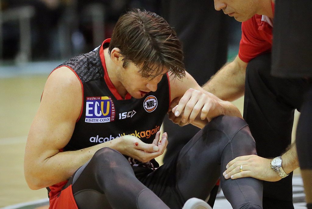 Perth Wildcats captain Damian Martin suffers a broken jaw during the NBL game against the Townsville Crocodiles in Townsville. Photo: AAP Image/Perth Wildcats Perth Wildcats captain Damian Martin suffers a broken jaw during the NBL game against the Townsville Crocodiles in Townsville. Photo: AAP Image/Perth Wildcats
