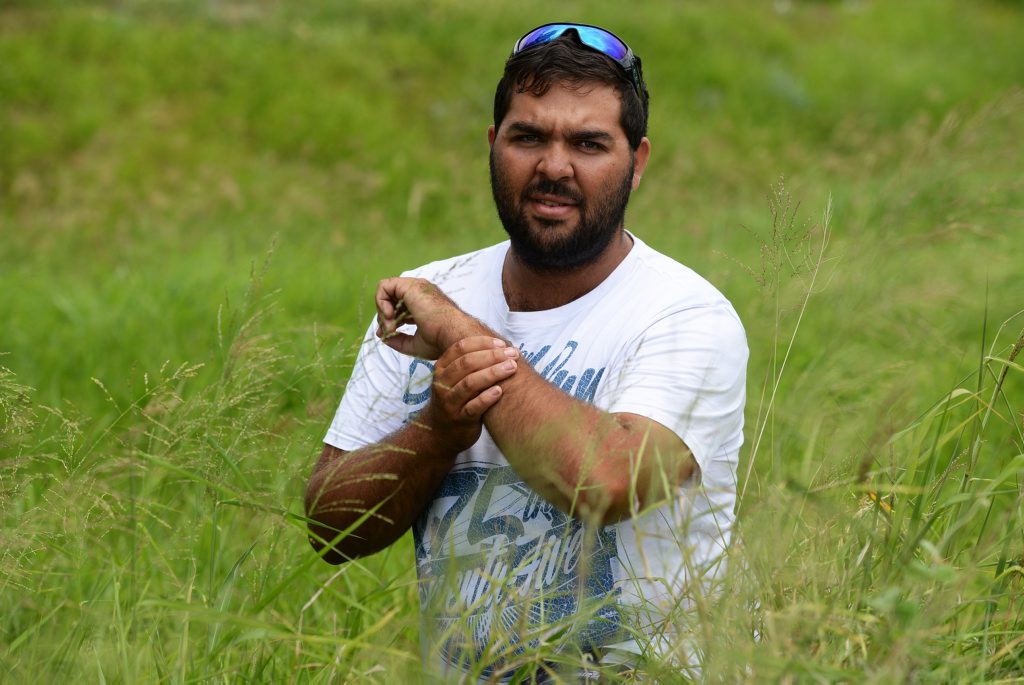 SNAKE SEASON: Dominic Pope was bitten by a snake while working at a farm in Bundaberg. SNAKE SEASON: Dominic Pope was bitten by a snake while working at a farm in Bundaberg.