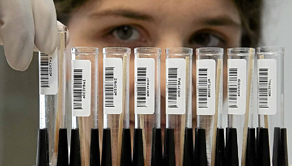SIMPLE SALIVA: Beating heart disease may be helped by taking saliva samples such as these. SIMPLE SALIVA: Beating heart disease may be helped by taking saliva samples such as these.