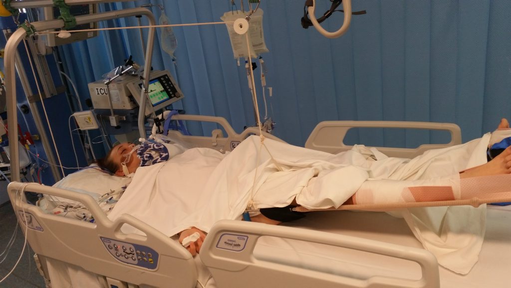 Kintara Andrews is now recovering 12 months after beening hit by a car crossing the Bruce Highway, Gympie.CONTRIBUTED Kintara Andrews is now recovering 12 months after beening hit by a car crossing the Bruce Highway, Gympie.CONTRIBUTED