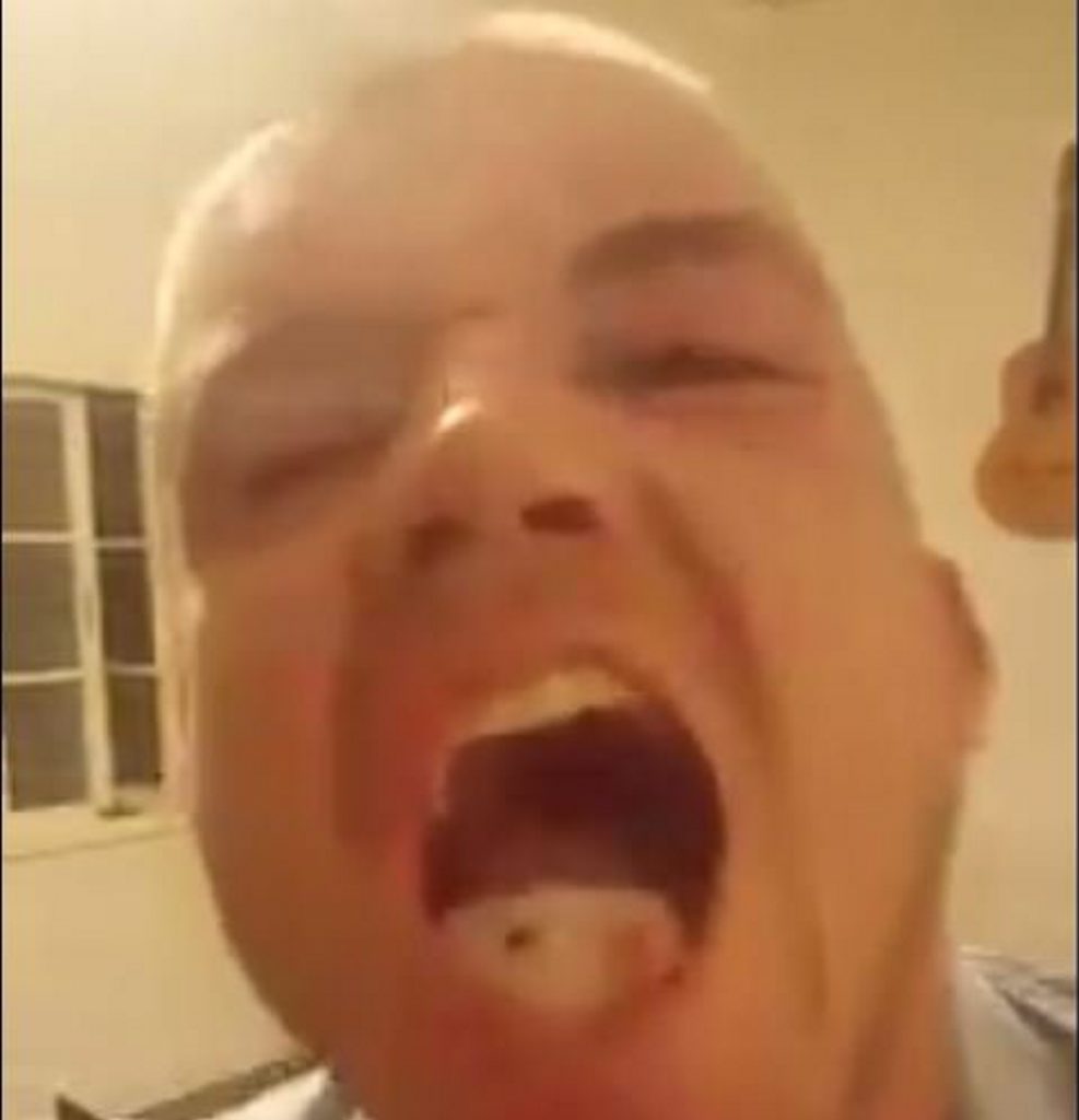 Matt Maloney show's the rat's head in his mouth to the camera. Matt Maloney show's the rat's head in his mouth to the camera.