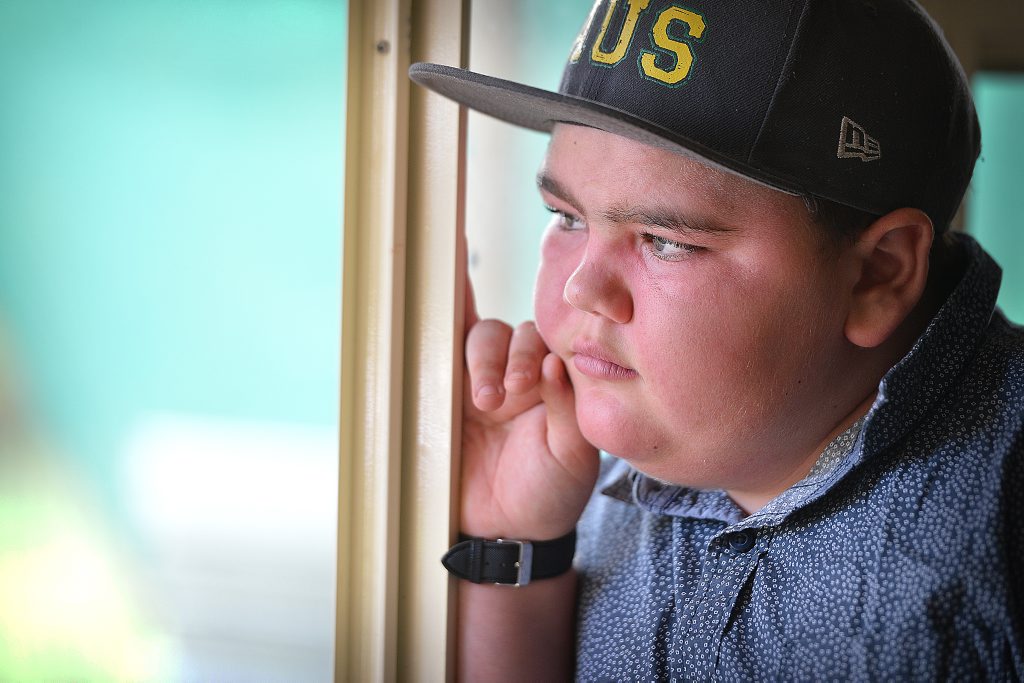 JAXON McGourty suffers from Juvenile Dermatomyositis. JAXON McGourty suffers from Juvenile Dermatomyositis.