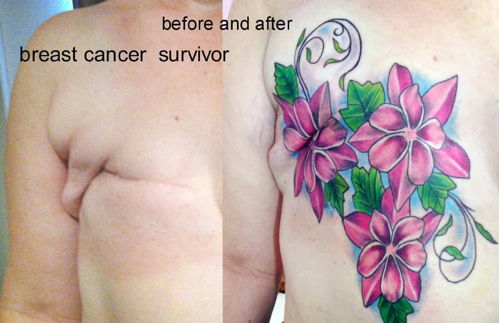 HEALING PROCESS: Before and after of a mastectomy scar cover up Susan has done. HEALING PROCESS: Before and after of a mastectomy scar cover up Susan has done.
