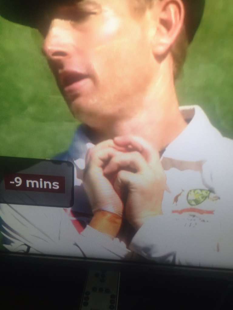 Adam Voges was wearing strapping tape on his right wrist when he caught Corey Anderson - this gave the optical illusion of a surgical glove. Adam Voges was wearing strapping tape on his right wrist when he caught Corey Anderson - this gave the optical illusion of a surgical glove.