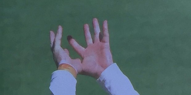 Adam Voges was wearing strapping tape on his right wrist when he caught Corey Anderson - this gave the optical illusion of a surgical glove. Adam Voges was wearing strapping tape on his right wrist when he caught Corey Anderson - this gave the optical illusion of a surgical glove.