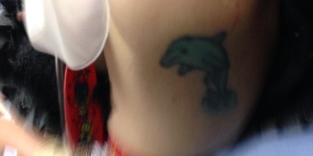 The dolphin tattoo that was an early clue to the woman's identity. The dolphin tattoo that was an early clue to the woman's identity.