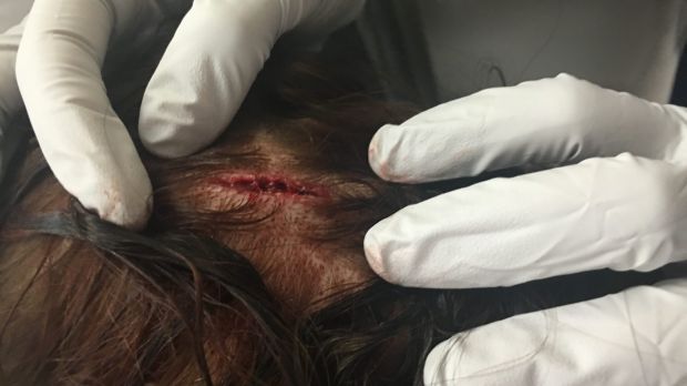 A 21-year-old woman's injuries from an alleged A 21-year-old woman's injuries from an alleged