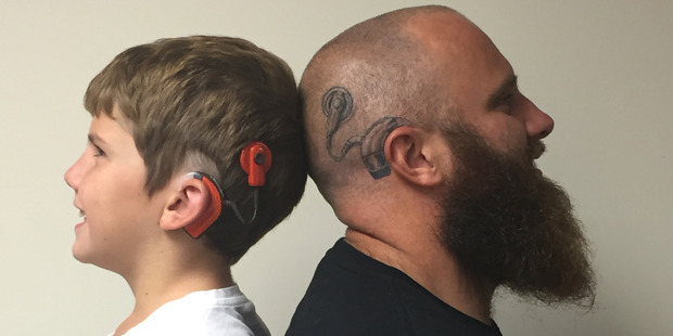 Alistair Campbell has a second tattoo above his right ear to match the cochlear implant of his older son, Lewis, 9.
Alistair Campbell has a second tattoo above his right ear to match the cochlear implant of his older son, Lewis, 9.