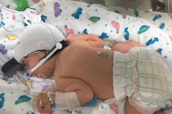 Baby Willa is said to be doing well. Baby Willa is said to be doing well.