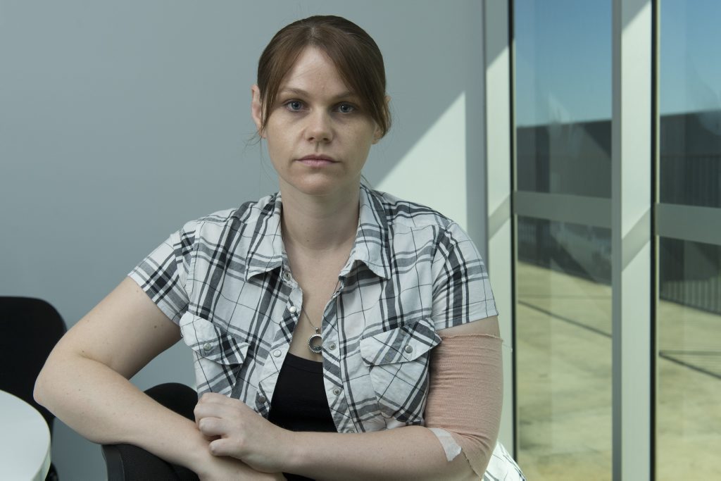 Zoe McDougall suffers from Lyme disease but will not get any government help because the condition is not recognised, Sunday, April 24, 2016. Zoe McDougall suffers from Lyme disease but will not get any government help because the condition is not recognised, Sunday, April 24, 2016.
