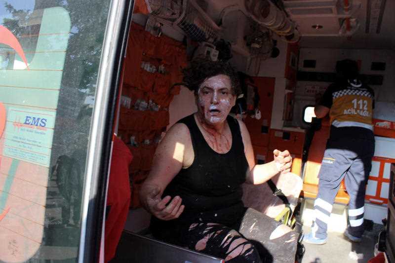 An injured person sits in an ambulance after a suicide bomb attack outside the historical tourist destination at Ulu Cami in Bursa, Turkey, Wednesday, April 27, 2016. The office of the governor of Bursa said in a statement carried by the state-owned Anadolu Agency that a woman believed to be a suicide bomber blew herself up. An injured person sits in an ambulance after a suicide bomb attack outside the historical tourist destination at Ulu Cami in Bursa, Turkey, Wednesday, April 27, 2016. The office of the governor of Bursa said in a statement carried by the state-owned Anadolu Agency that a woman believed to be a suicide bomber blew herself up.