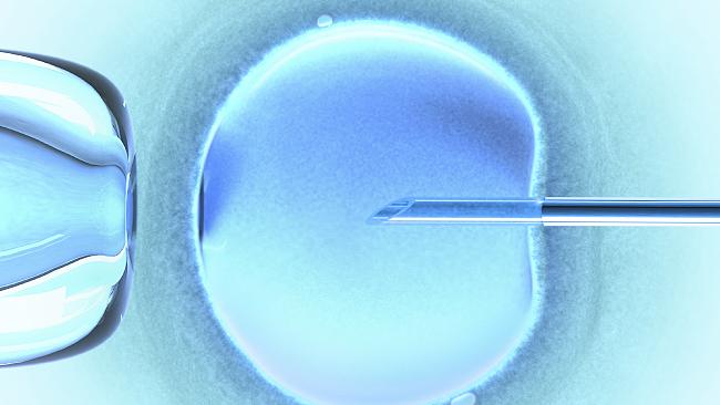 There is an urgent need to extract sperm from a dead body quickly. If it's not taken within 24 hours the sperm may not be usable. There is an urgent need to extract sperm from a dead body quickly. If it's not taken within 24 hours the sperm may not be usable.
