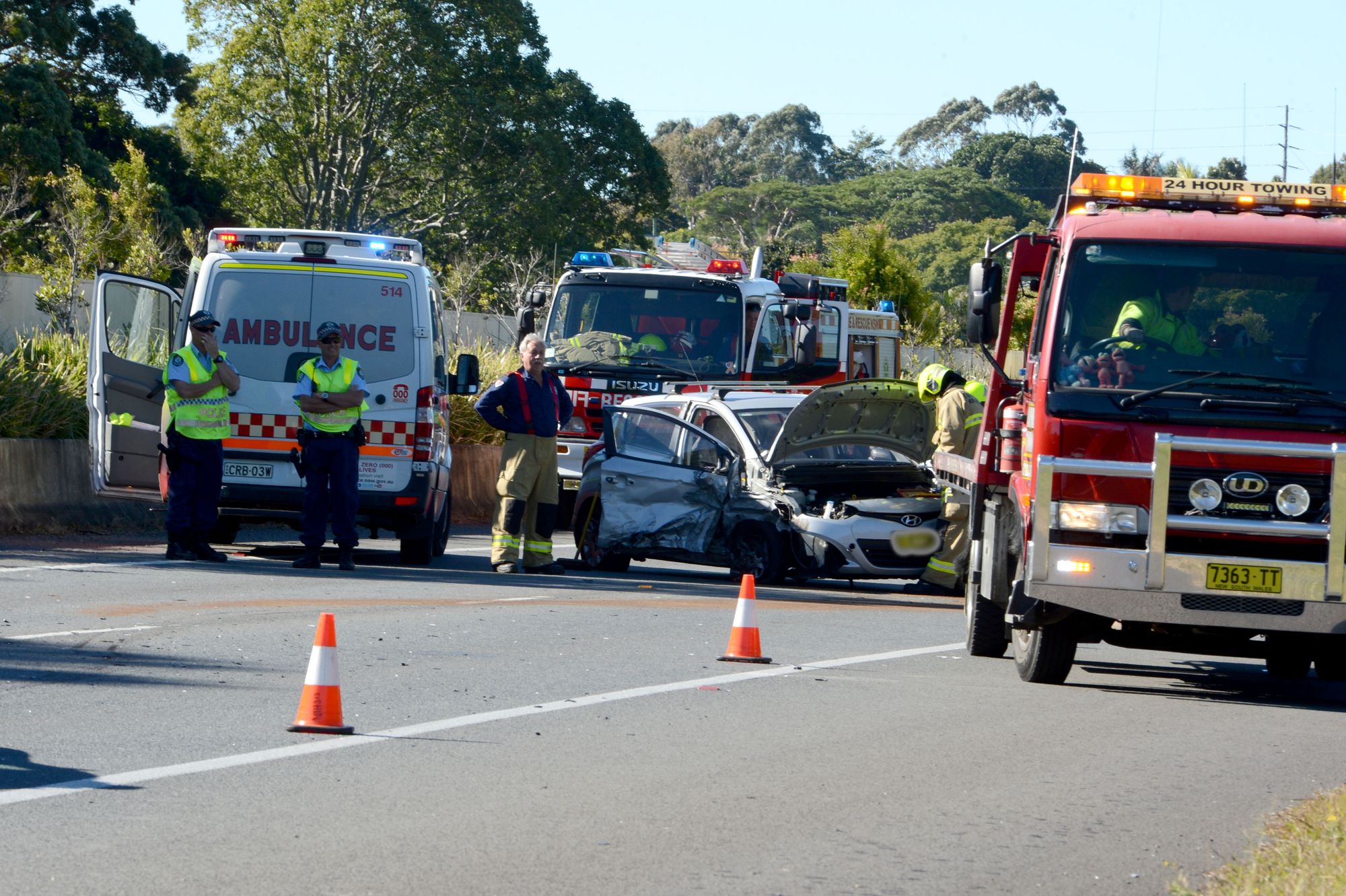 Fewer Australians are suffering severe traumatic brain injuries on our roads Fewer Australians are suffering severe traumatic brain injuries on our roads