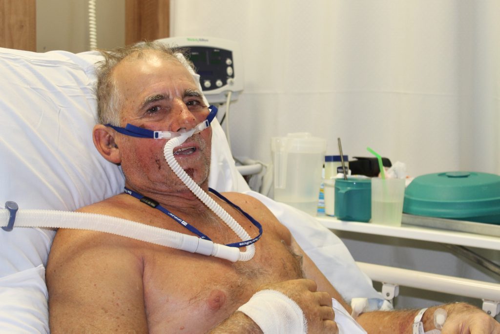TOUGH AS NAILS: Graeme Ware, 66, a cattle farmer from Pinnacle speaks from Mackay Base Hospital after he was gored by a wild bull on Monday. TOUGH AS NAILS: Graeme Ware, 66, a cattle farmer from Pinnacle speaks from Mackay Base Hospital after he was gored by a wild bull on Monday.