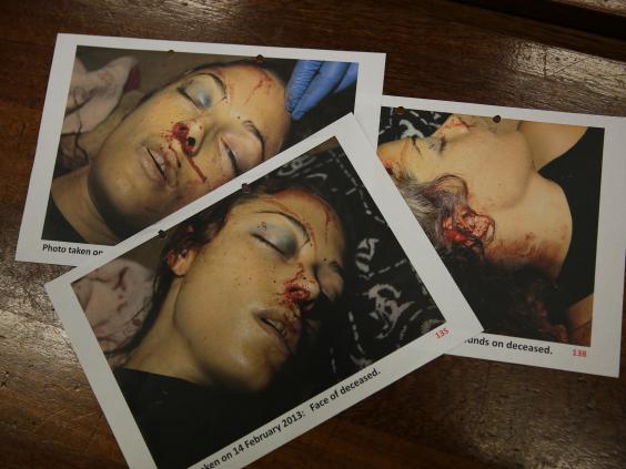 GRAPHIC CONTENT: Handout images release by Pretoria High Court, exhibit pictures of Reeva Steenkamp are seen after the court released them to be published GRAPHIC CONTENT: Handout images release by Pretoria High Court, exhibit pictures of Reeva Steenkamp are seen after the court released them to be published