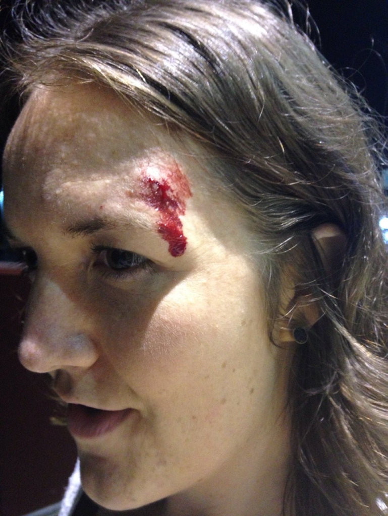 Cassie Holeczy after getting caught up in the cross fire of an 'out of control crowd'. Cassie Holeczy after getting caught up in the cross fire of an 'out of control crowd'.