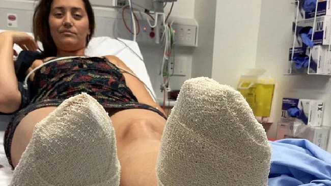 Mental note: Never walking barefoot in this country again. Picture: Joanne Hall/Facebook. Mental note: Never walking barefoot in this country again. Picture: Joanne Hall/Facebook.