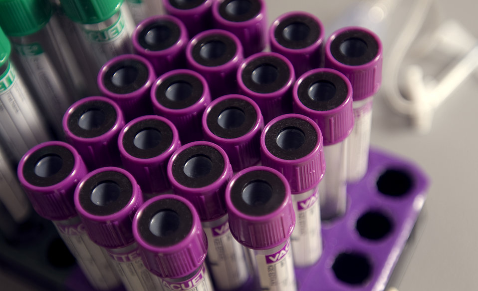 CSIRO, Flinders University and Clinical Genomics jointly developed the bowel cancer Colvera test. CSIRO, Flinders University and Clinical Genomics jointly developed the bowel cancer Colvera test.