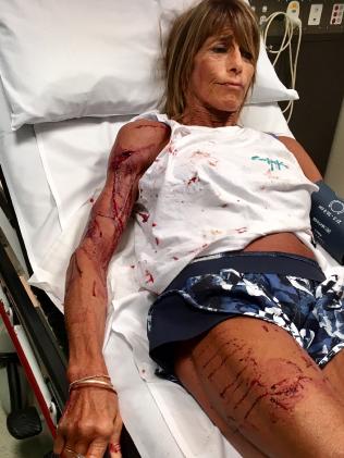 Debbie Urquhart recovering from the horrifying attack. Debbie Urquhart recovering from the horrifying attack.